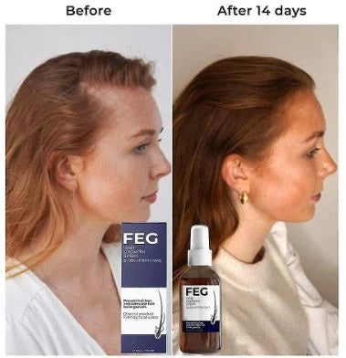 FEG Hair Growth Spray / رذاذ نمو الشعر